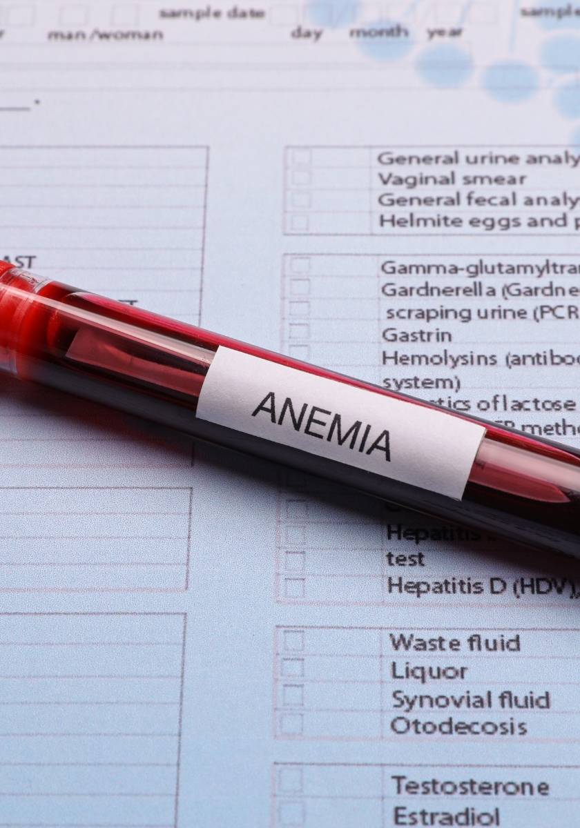 Blood tube labeled anemia beside a laboratory test form