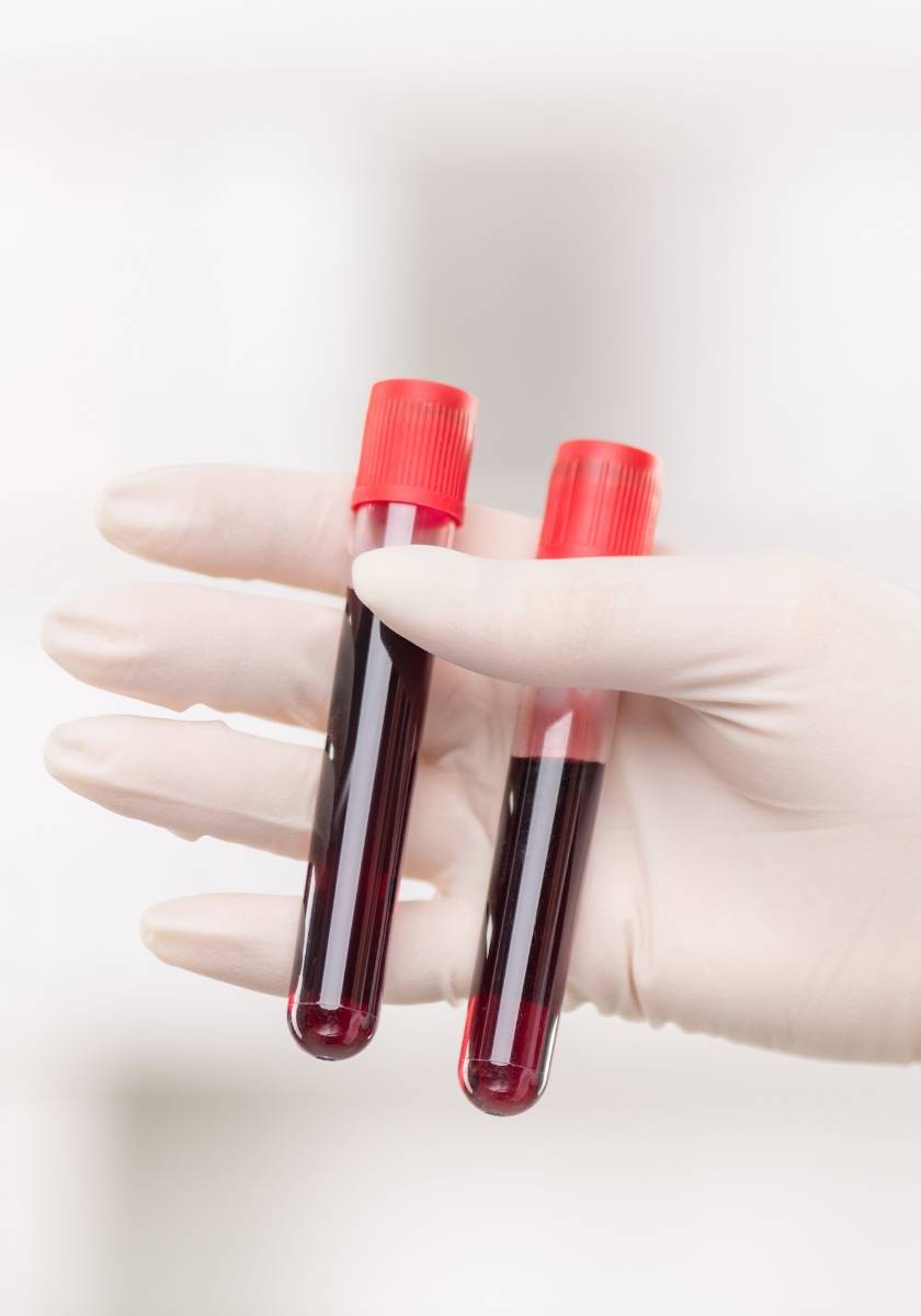 Gloved hand holding blood collection tubes in a laboratory