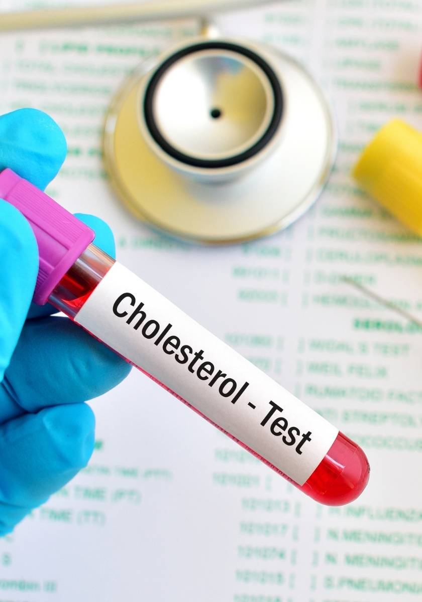 Cholesterol test paper with stethoscope and medical items